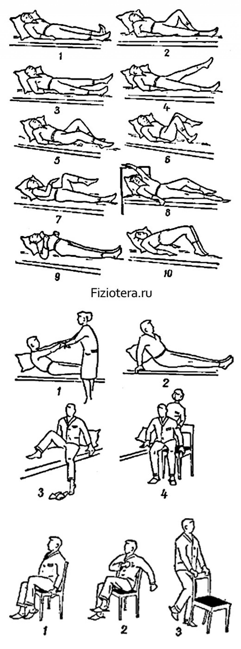 Инсульт занятия для восстановления. Комплекс лечебной гимнастики 1 при инфаркте миокарда. Комплекс упражнений при реабилитации после инсульта. Лечебная физкультура в период реабилитации после инфаркта миокарда. ЛФК после инфаркта комплекс упражнений.