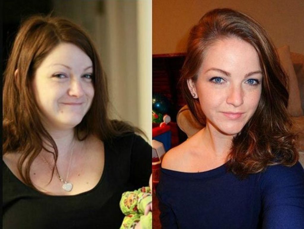 До и после. Лицо до и после похудения. Лицо до и после похудения женщины. Лицо после похудения до и после. Толстое лицо до и после.