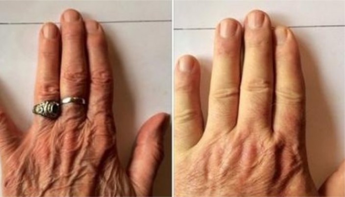 Общая длина пальцев