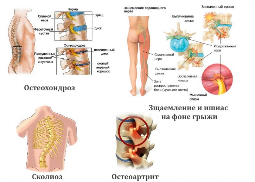 Причины болей в шее