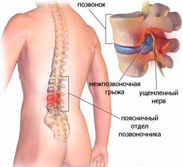 За сколько можно накачать красивые ягодицы приседаниями?