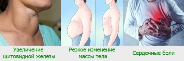 Признаки дефицита йода